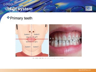 Fdi Temporal Comprehensive Guide to Tooth Nomenclature and Notation Systems in ...