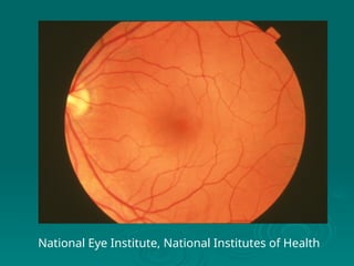 National Eye Institute, National Institutes of Health
 