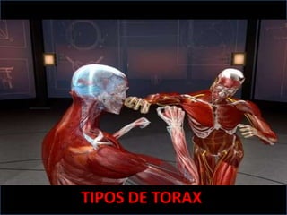 TIPOS DE TORAX
 