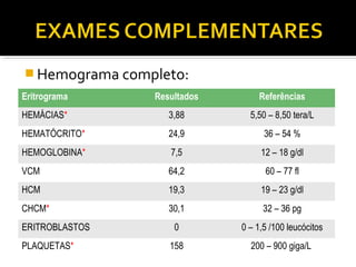 Hemograma completo:
Eritrograma Resultados Referências
HEMÁCIAS* 3,88 5,50 – 8,50 tera/L
HEMATÓCRITO* 24,9 36 – 54 %
HEMOGLOBINA* 7,5 12 – 18 g/dl
VCM 64,2 60 – 77 fl
HCM 19,3 19 – 23 g/dl
CHCM* 30,1 32 – 36 pg
ERITROBLASTOS 0 0 – 1,5 /100 leucócitos
PLAQUETAS* 158 200 – 900 giga/L
 