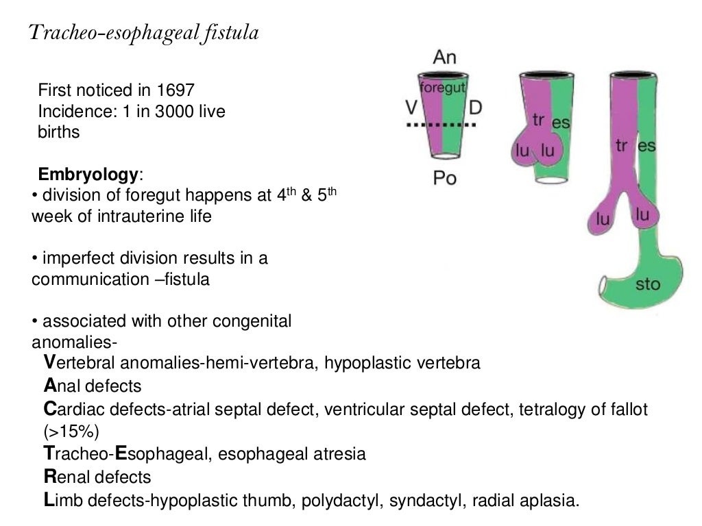 Tracheo Esophageal Fistula and Anesthesia