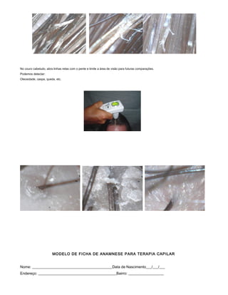 No couro cabeludo, abra linhas retas com o pente e limite a área de visão para futuras comparações.
Podemos detectar:
Oleosidade, caspa, queda, etc.
MODELO DE FICHA DE ANAMNESE PARA TERAPIA CAPILAR
Nome: ___________________________________________Data de Nascimento___/___/___
Endereço: __________________________________________Bairro: ___________________
 