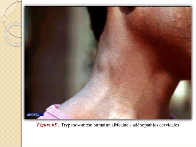 1 trypanosoma