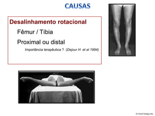 Desalinhamento rotacional
Fêmur / Tíbia
Proximal ou distal
Importância terapêutica ? (Dejour H et al 1994)
Dr David Sadigursky
 
