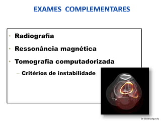 • Radiografia
• Ressonância magnética
• Tomografia computadorizada
– Critérios de instabilidade
Dr David Sadigursky
 