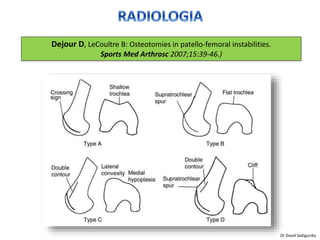 Dejour D, LeCoultre B: Osteotomies in patello-femoral instabilities.
Sports Med Arthrosc 2007;15:39-46.)
Dr David Sadigursky
 