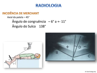 Axial da patela – 45°
Ângulo de congruência – 6° a +- 11°
Ângulo do Sulco 138°
Dr David Sadigursky
 
