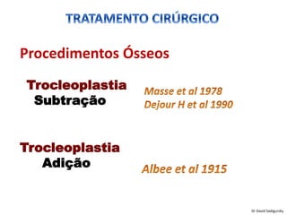 Procedimentos Ósseos
Trocleoplastia
Adição
Trocleoplastia
Subtração
Dr David Sadigursky
 
