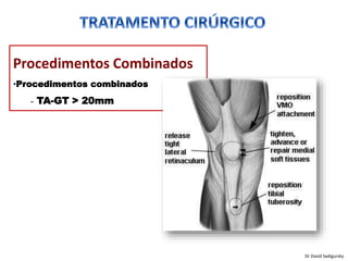 Procedimentos Combinados
•Procedimentos combinados
˗ TA-GT > 20mm
Dr David Sadigursky
 