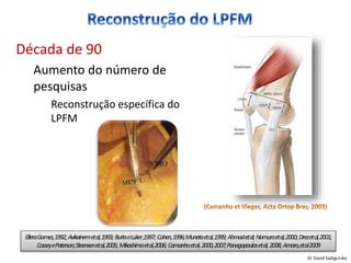 Década de 90
Aumento do número de
pesquisas
Reconstrução específica do
LPFM
ElleraGomes,1992; Avikainemetal,1993; BurkseLuker,1997; Cohen,1996;Munetaetal,1999; Ahmadetal;Nomuraetal,2000; Drezetal,2001;
CosseyePaterson;Steensenetal,2005; Mikashimaetal,2006; Camanhoetal,2000,2007;Panagopoulosetal,2008; Amaro,etal2009
Dr David Sadigursky
 