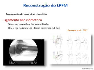 Ligamento não isómetrico
Tenso em extensão / frouxo em flexão
Diferença na isometria - fibras proximais e distais
Reconstrução não isométrica vs isométrica
Dr David Sadigursky
 