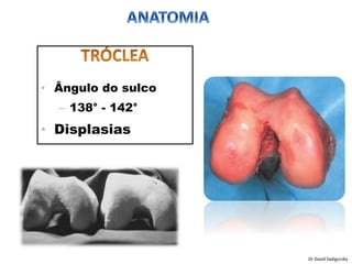 • Ângulo do sulco
– 138° - 142°
• Displasias
Dr David Sadigursky
 