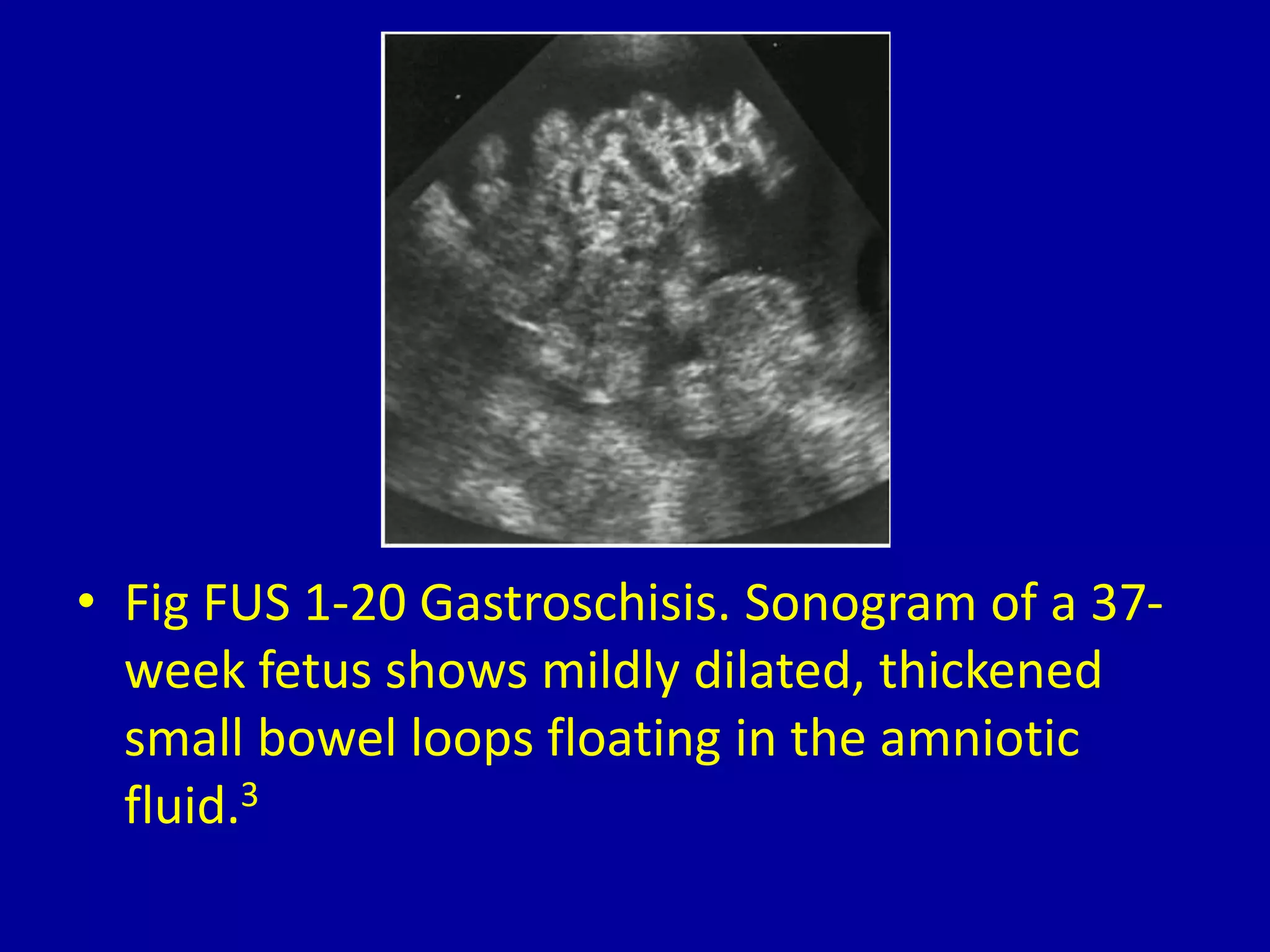 1 ultrasound diagnosis of fetal anomalies | PPTX