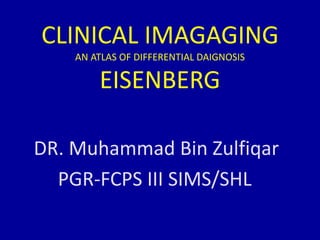 CLINICAL IMAGAGING
AN ATLAS OF DIFFERENTIAL DAIGNOSIS
EISENBERG
DR. Muhammad Bin Zulfiqar
PGR-FCPS III SIMS/SHL
 