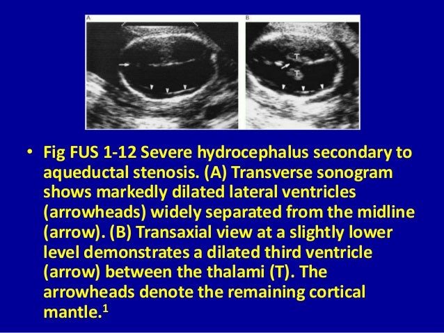 The Anomalies Of Fetus Ultrasound