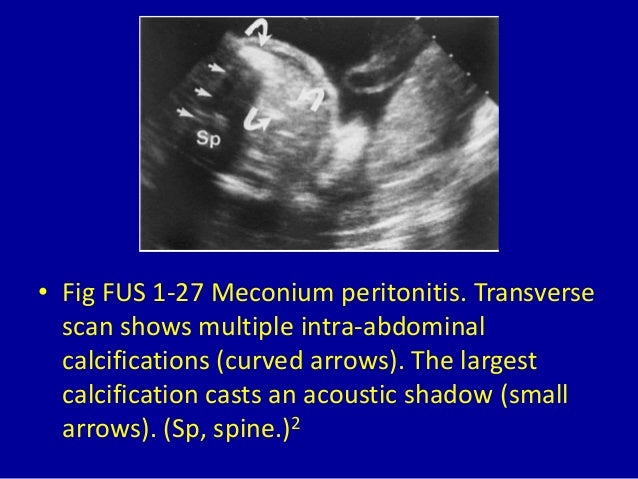 The Anomalies Of Fetus Ultrasound