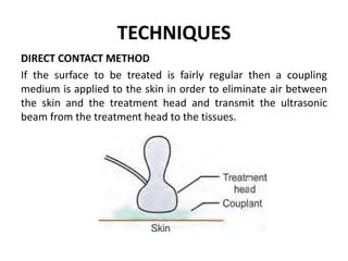 TECHNIQUES
DIRECT CONTACT METHOD
If the surface to be treated is fairly regular then a coupling
medium is applied to the skin in order to eliminate air between
the skin and the treatment head and transmit the ultrasonic
beam from the treatment head to the tissues.
 