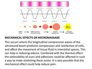 MECHANICAL EFFECTS OR MICROMASSAGE
This occurs where the longitudinal compression waves of the
ultrasound beam produces compression and rarefaction of cells,
and affect the movement of tissue fluid in interstitial spaces. This
can help in reducing edema. Combined with the thermal effect
the extensibility of scars and adhesions could be affected in such
a way to make stretching them easier. It is also possible that the
mechanical effect could help reduce pain.
 