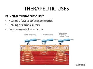 THERAPEUTIC USES
PRINCIPAL THERAPEUTIC USES
• Healing of acute soft tissue injuries
• Healing of chronic ulcers
• Improvement of scar tissue
GAYATHRI
 