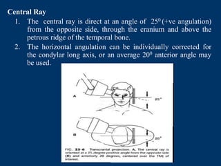 Petrous Ridge Positioning Chart 1_updated_temporomandibularjointimaging-180225163412 2.pdf