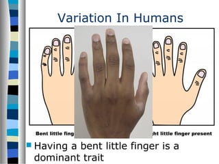 Variation In Humans
 Having a bent little finger is a
dominant trait
 