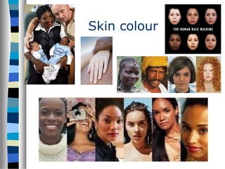 Skin colour
 