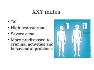 XXY males

Tall

High testosterone

Severe acne

More predisposed to
criminal activities and
behavioural problems
 