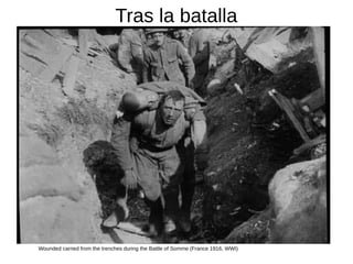 Tras la batalla
Wounded carried from the trenches during the Battle of Somme (France 1916, WWI)
 