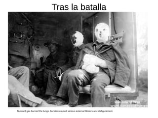 Tras la batalla
Mustard gas burned the lungs, but also caused serious external blisters and disfigurement.
 