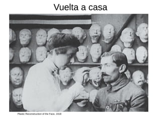 Vuelta a casa
Plastic Reconstruction of the Face, 1918
 