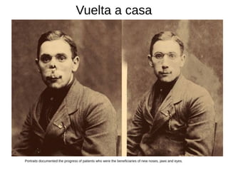Vuelta a casa
Portraits documented the progress of patients who were the beneficiaries of new noses, jaws and eyes.
 
