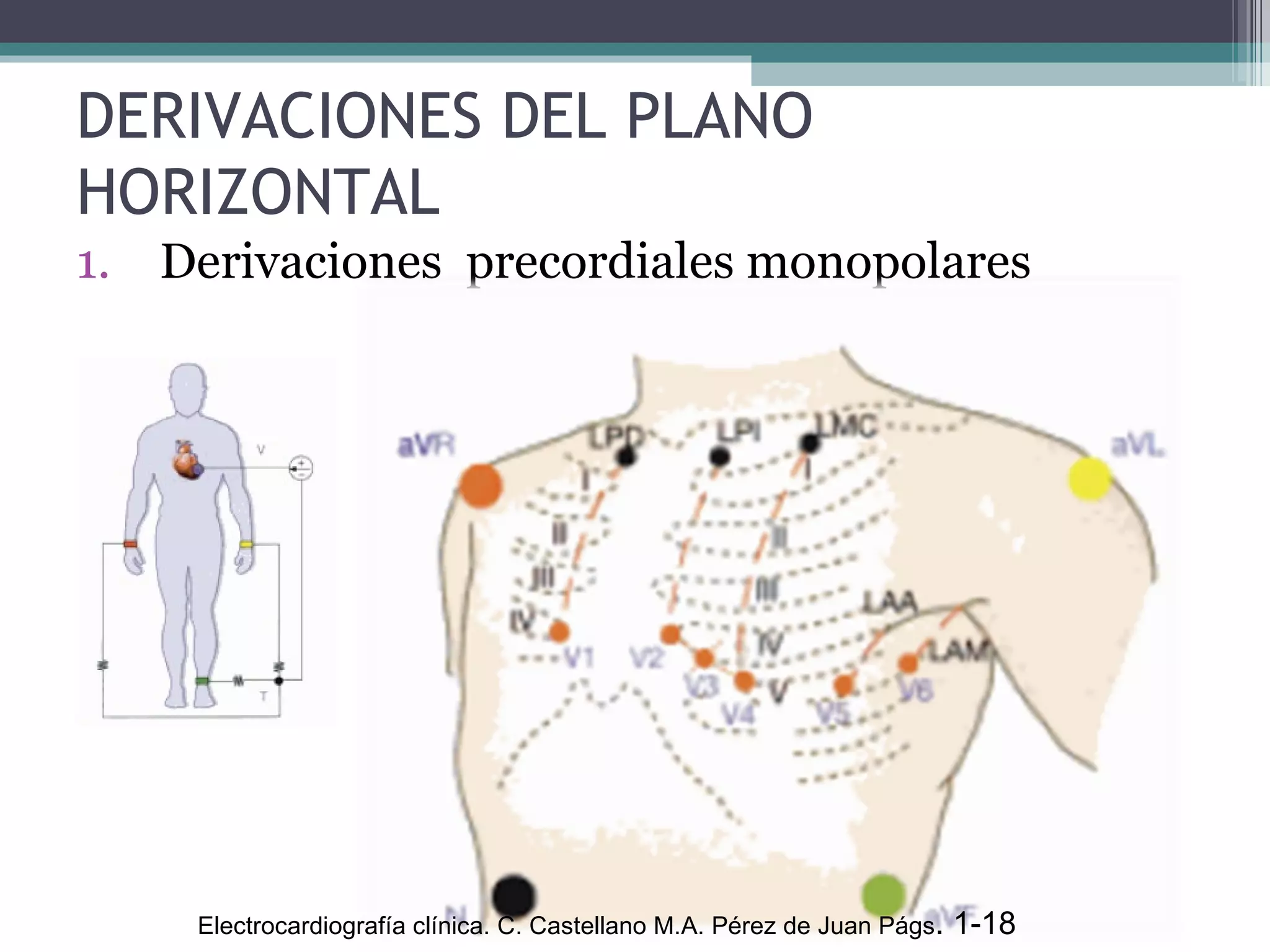 DERIVACIONES DEL PLANO HORIZONTAL Derivaciones  precordiales monopolares Electrocardiografía clínica. C. Castellano M.A. Pérez de Juan Págs . 1-18  
