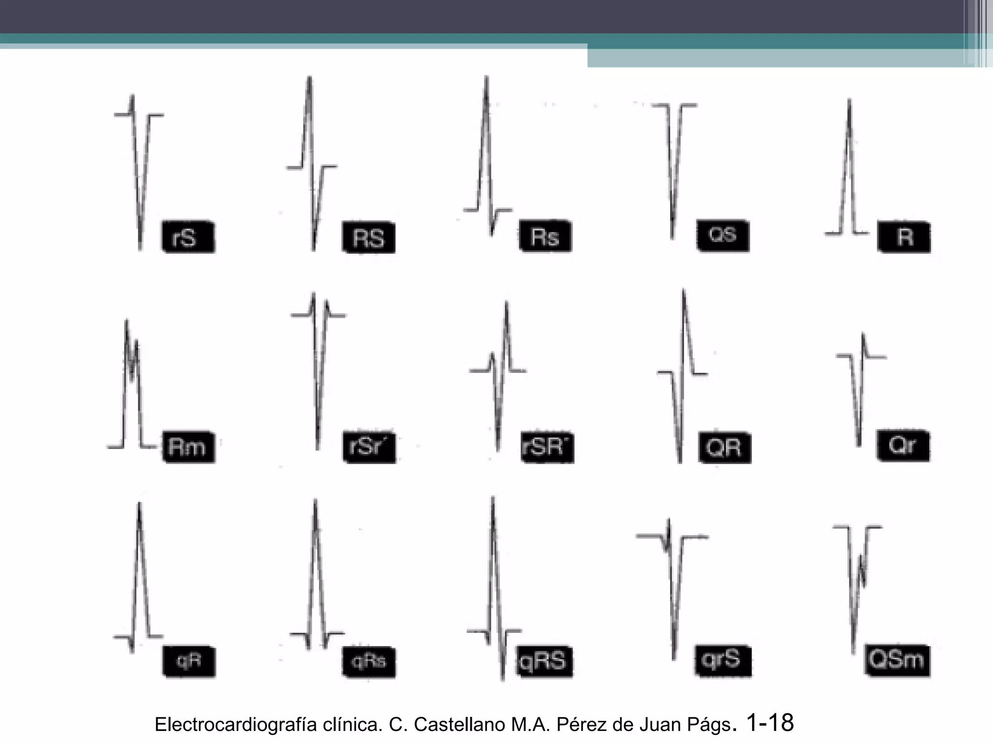 Electrocardiografía clínica. C. Castellano M.A. Pérez de Juan Págs . 1-18  