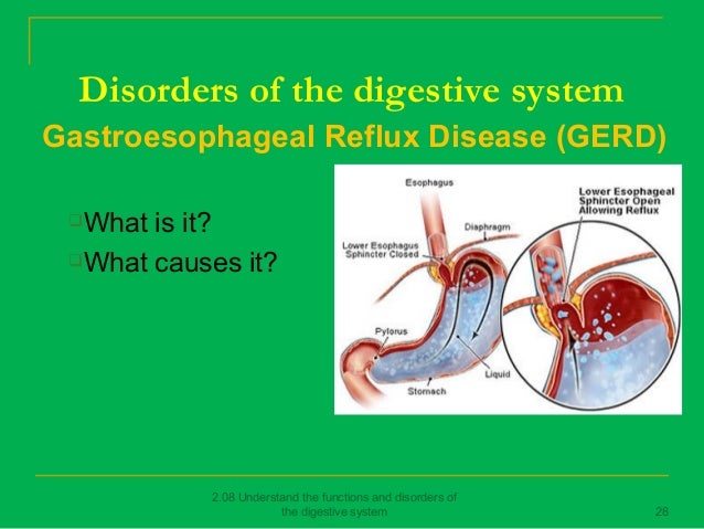 Digestive function dysfunction essay image