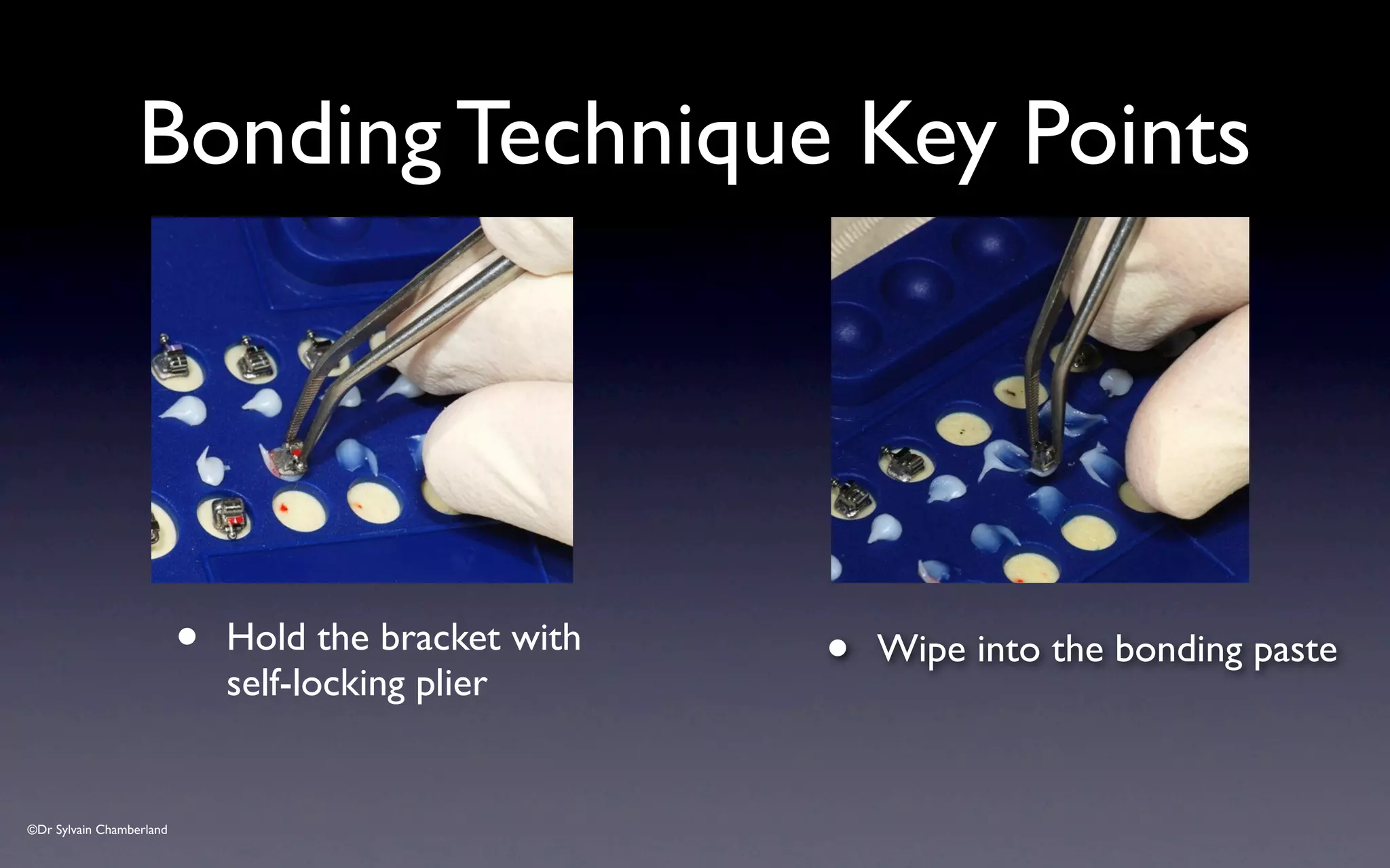 ©Dr Sylvain Chamberland
Bonding Technique Key Points
• Wipe into the bonding paste
• Hold the bracket with
self-locking plier
 