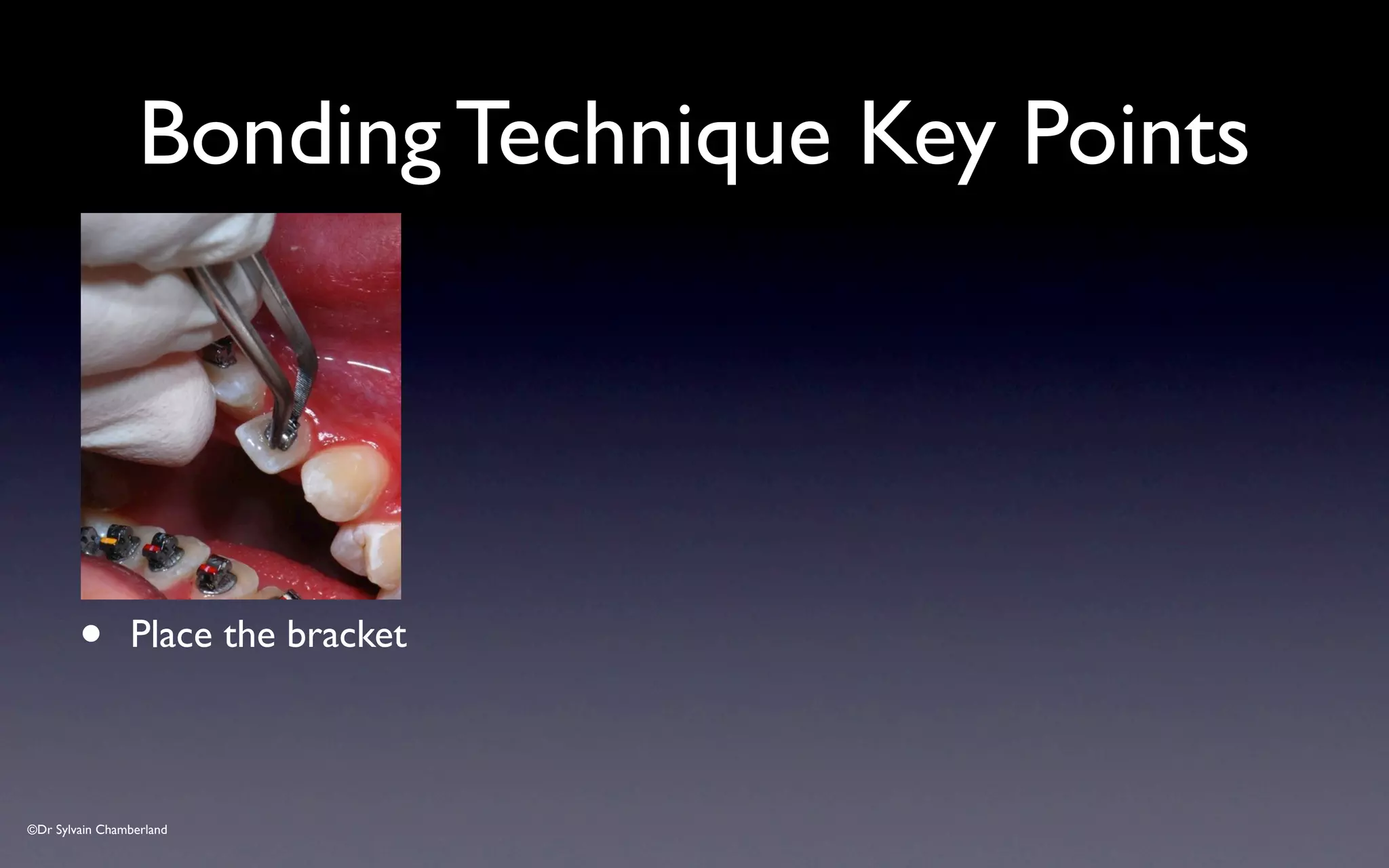 ©Dr Sylvain Chamberland
Bonding Technique Key Points
• Place the bracket
 