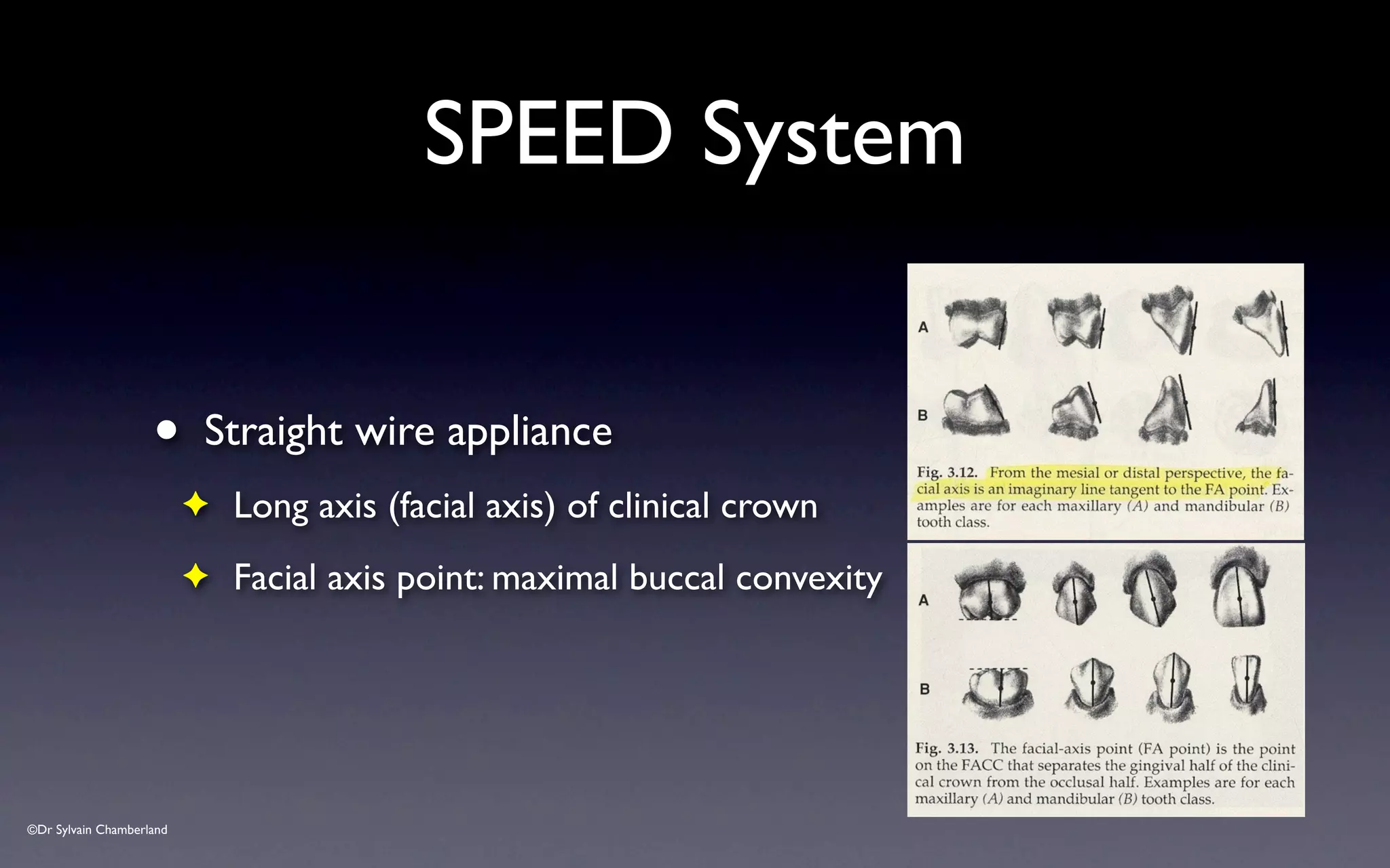©Dr Sylvain Chamberland
SPEED System
• Straight wire appliance
✦ Long axis (facial axis) of clinical crown
✦ Facial axis point: maximal buccal convexity
 