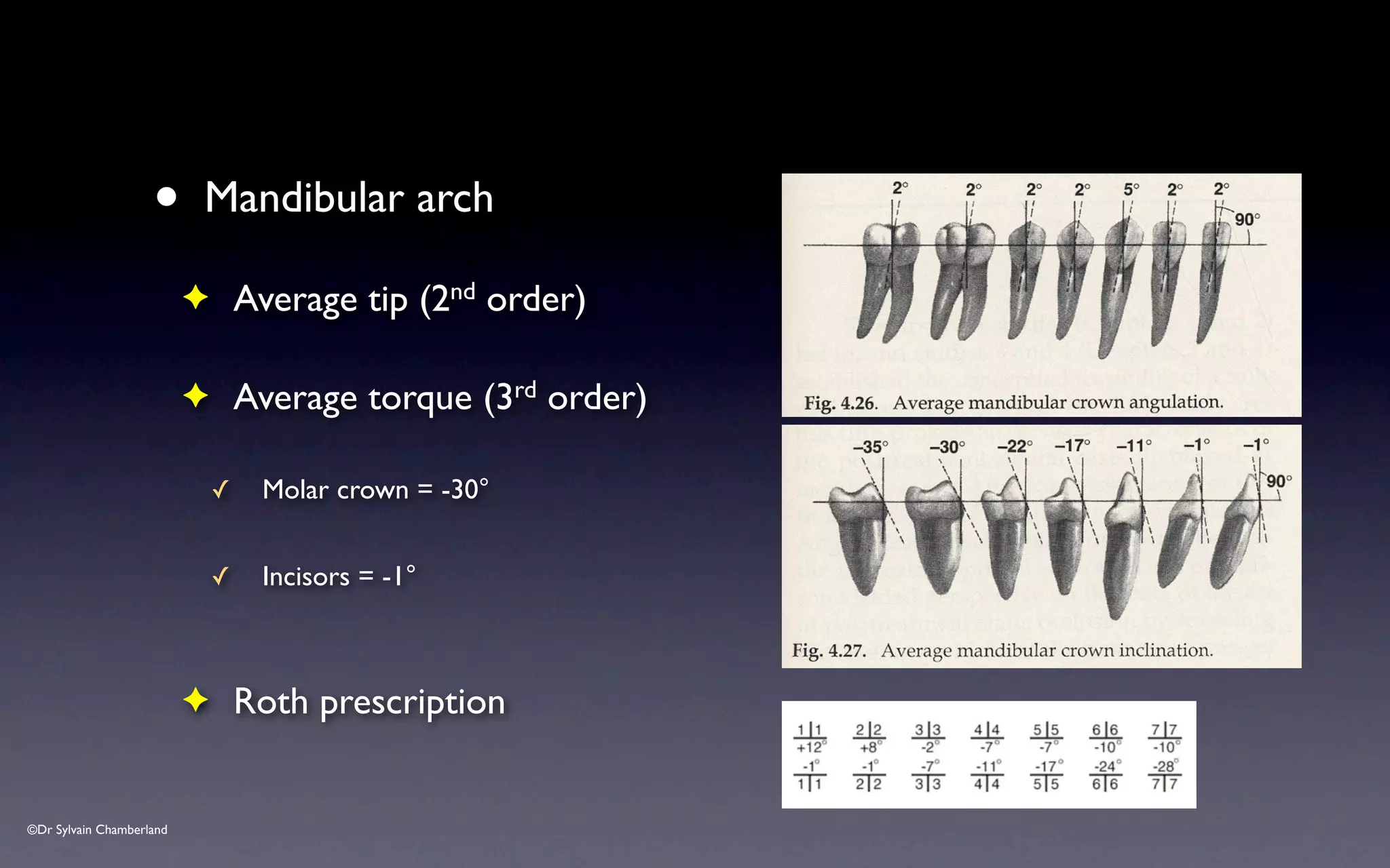 ©Dr Sylvain Chamberland
• Mandibular arch
✦ Average tip (2nd order)
✦ Average torque (3rd order)
✓ Molar crown = -30°
✓ Incisors = -1°
✦ Roth prescription
 