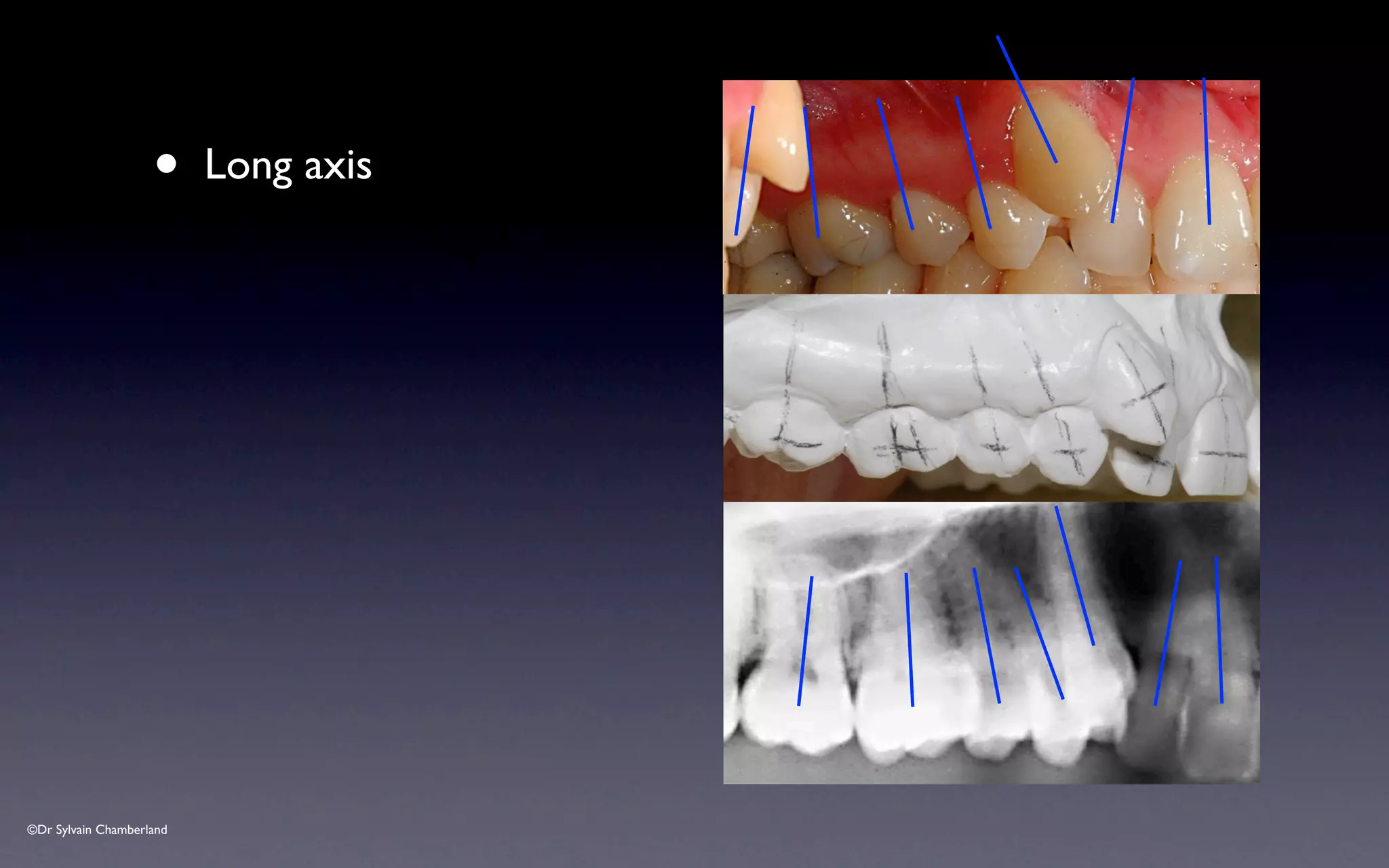 ©Dr Sylvain Chamberland
• Long axis
 