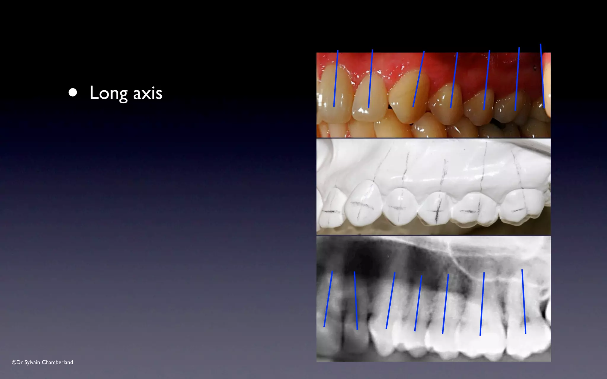 ©Dr Sylvain Chamberland
• Long axis
 