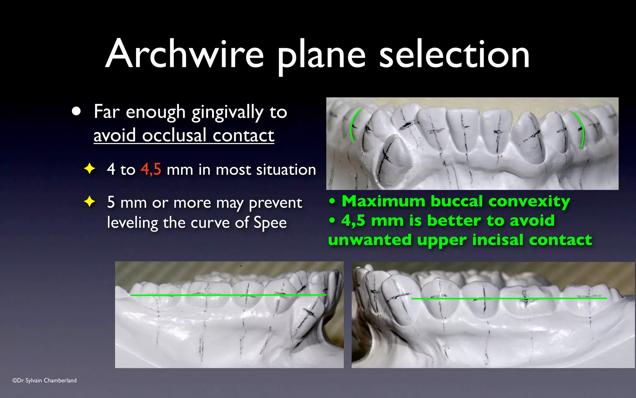 ©Dr Sylvain Chamberland
• Far enough gingivally to
avoid occlusal contact
✦ 4 to 4,5 mm in most situation
✦ 5 mm or more may prevent
leveling the curve of Spee
Archwire plane selection
• Maximum buccal convexity
• 4,5 mm is better to avoid
unwanted upper incisal contact
 