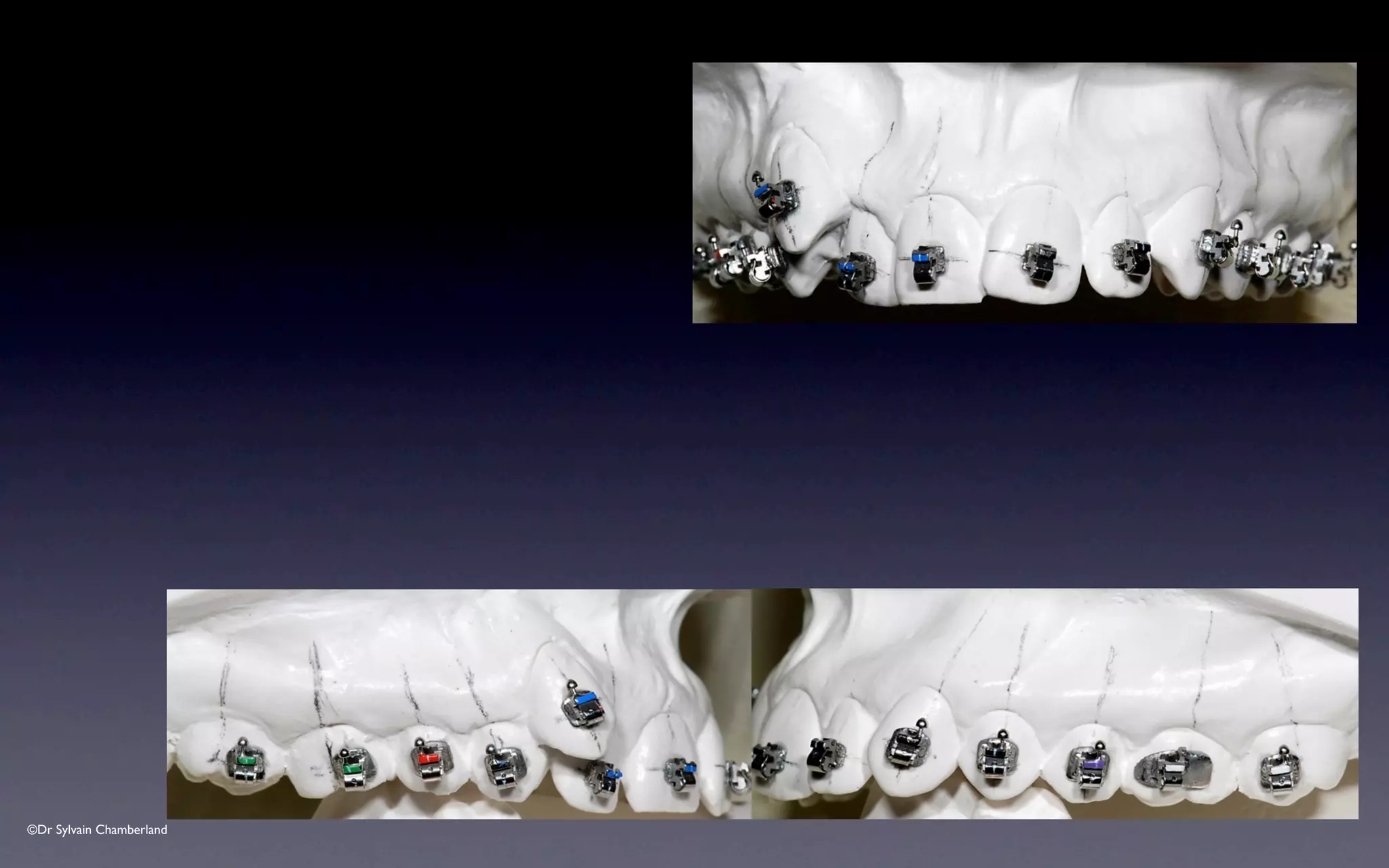 ©Dr Sylvain Chamberland
 