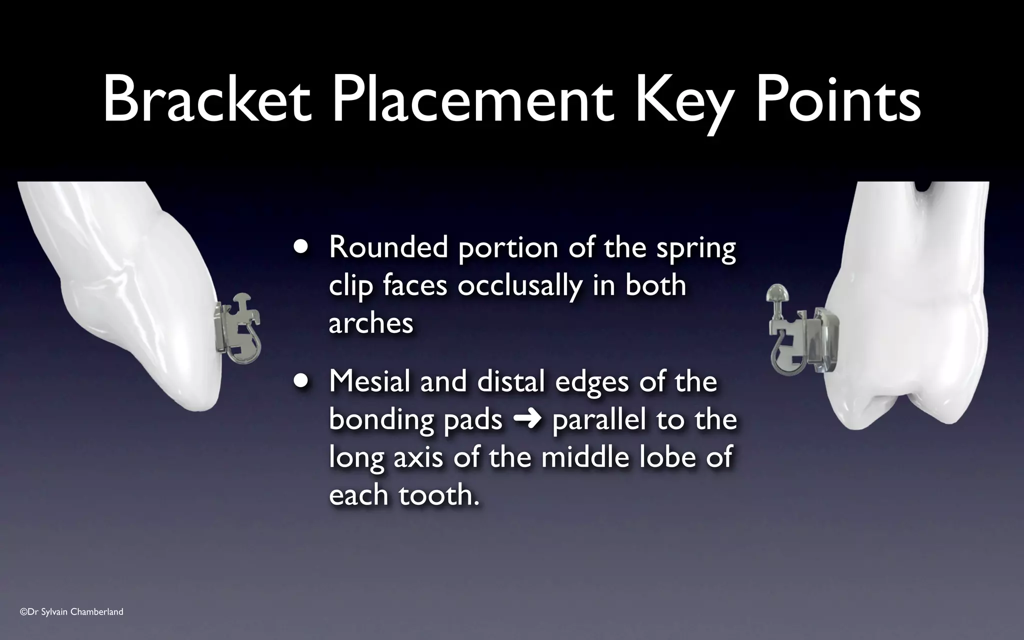 ©Dr Sylvain Chamberland
• Rounded portion of the spring
clip faces occlusally in both
arches
• Mesial and distal edges of the
bonding pads ➜ parallel to the
long axis of the middle lobe of
each tooth.
Bracket Placement Key Points
 