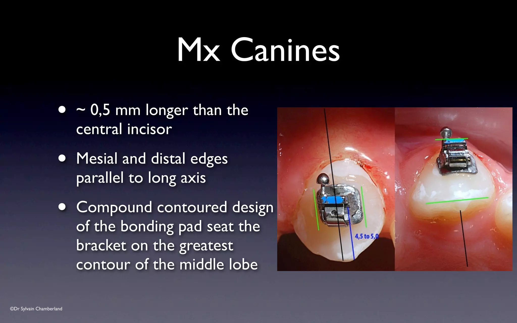 ©Dr Sylvain Chamberland
Mx Canines
• ~ 0,5 mm longer than the
central incisor
• Mesial and distal edges
parallel to long axis
• Compound contoured design
of the bonding pad seat the
bracket on the greatest
contour of the middle lobe
 