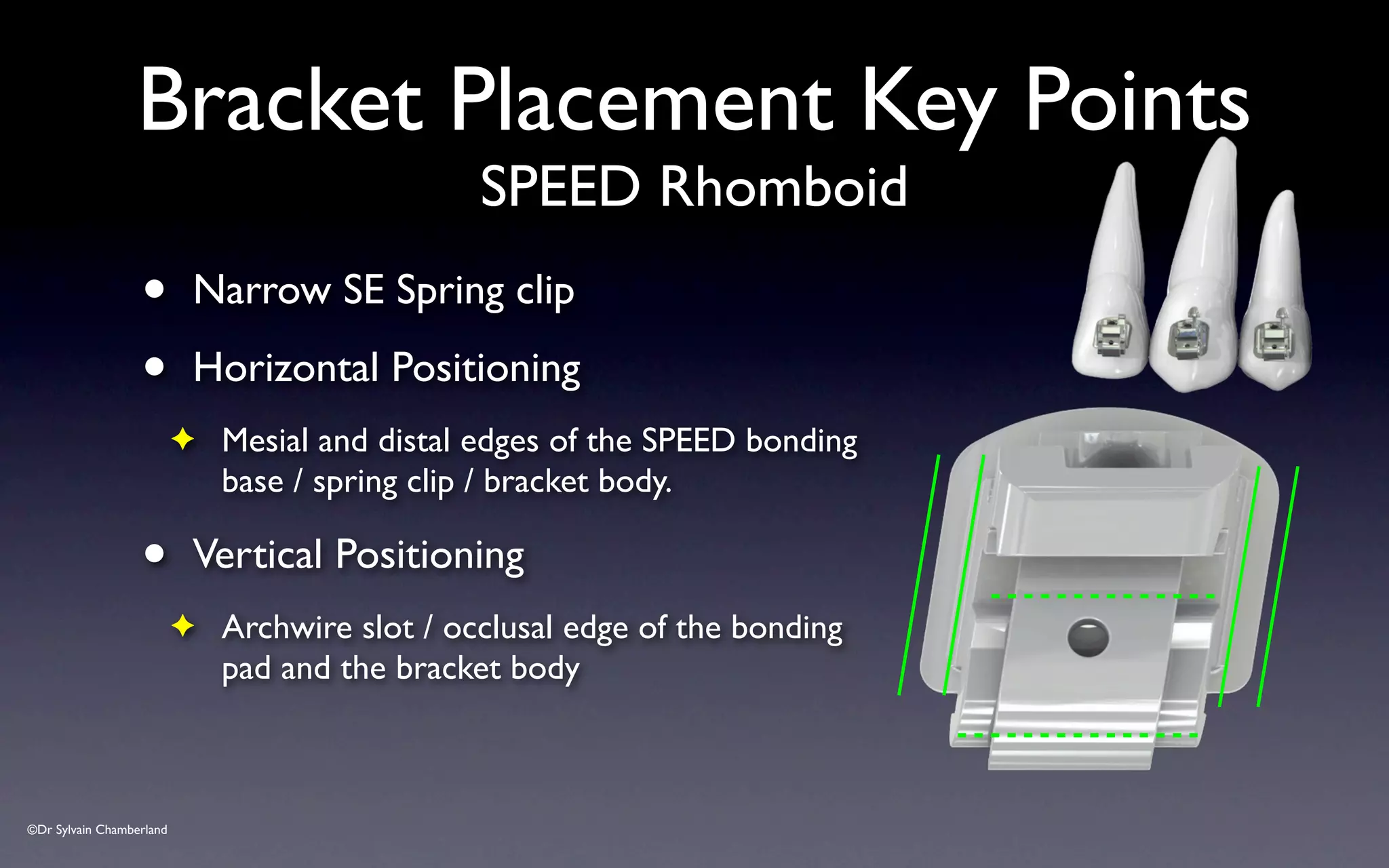 ©Dr Sylvain Chamberland
Bracket Placement Key Points
SPEED Rhomboid
• Narrow SE Spring clip
• Horizontal Positioning
✦ Mesial and distal edges of the SPEED bonding
base / spring clip / bracket body.
• Vertical Positioning
✦ Archwire slot / occlusal edge of the bonding
pad and the bracket body
 