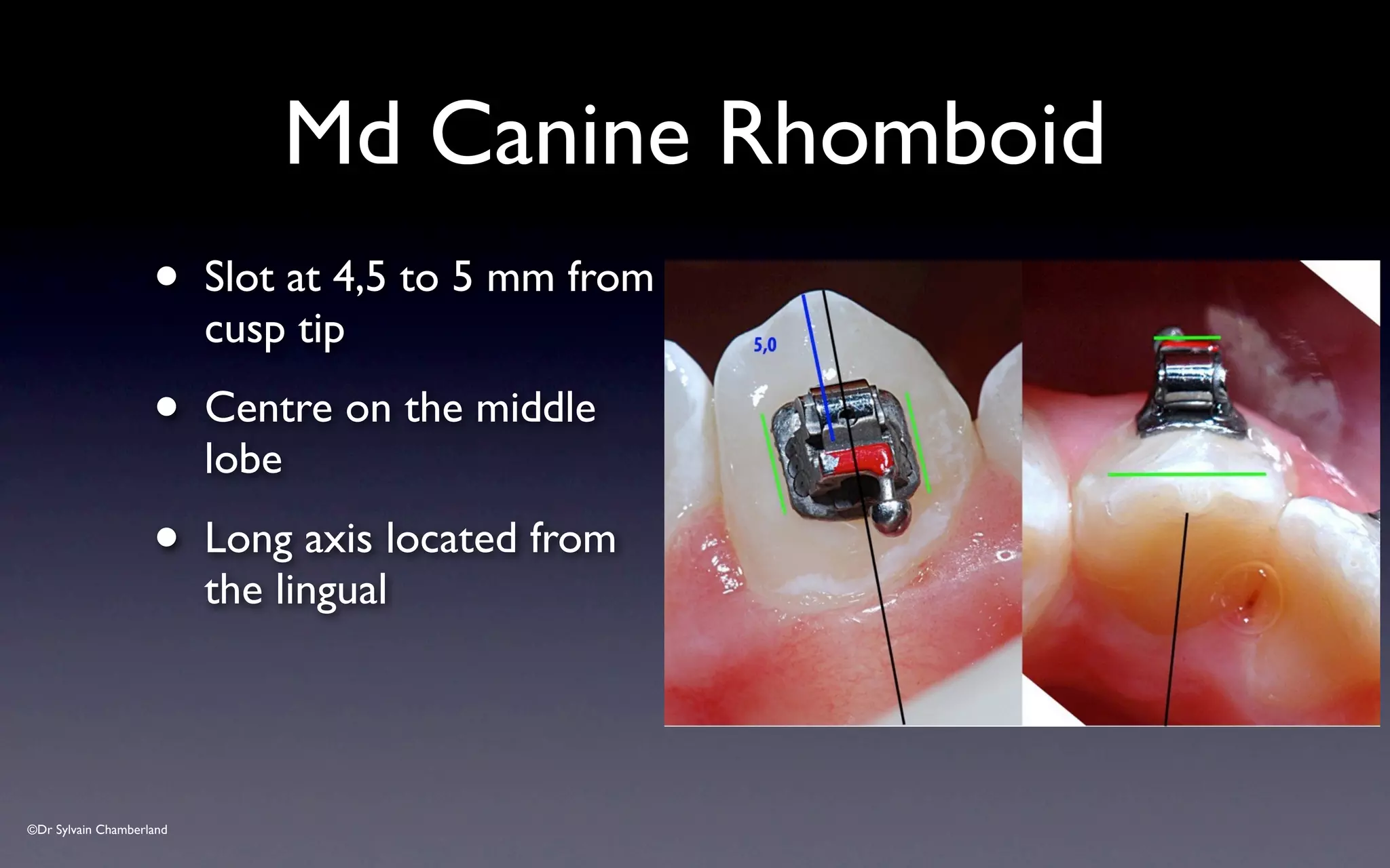 ©Dr Sylvain Chamberland
Md Canine Rhomboid
• Slot at 4,5 to 5 mm from
cusp tip
• Centre on the middle
lobe
• Long axis located from
the lingual
 