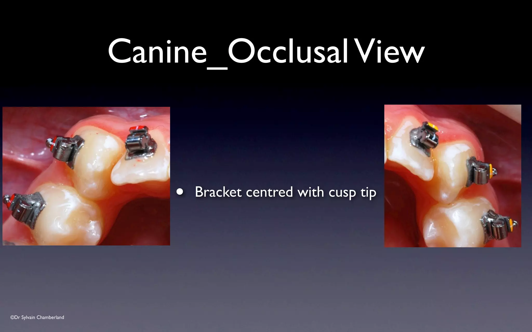 ©Dr Sylvain Chamberland
Canine_OcclusalView
• Bracket centred with cusp tip
 