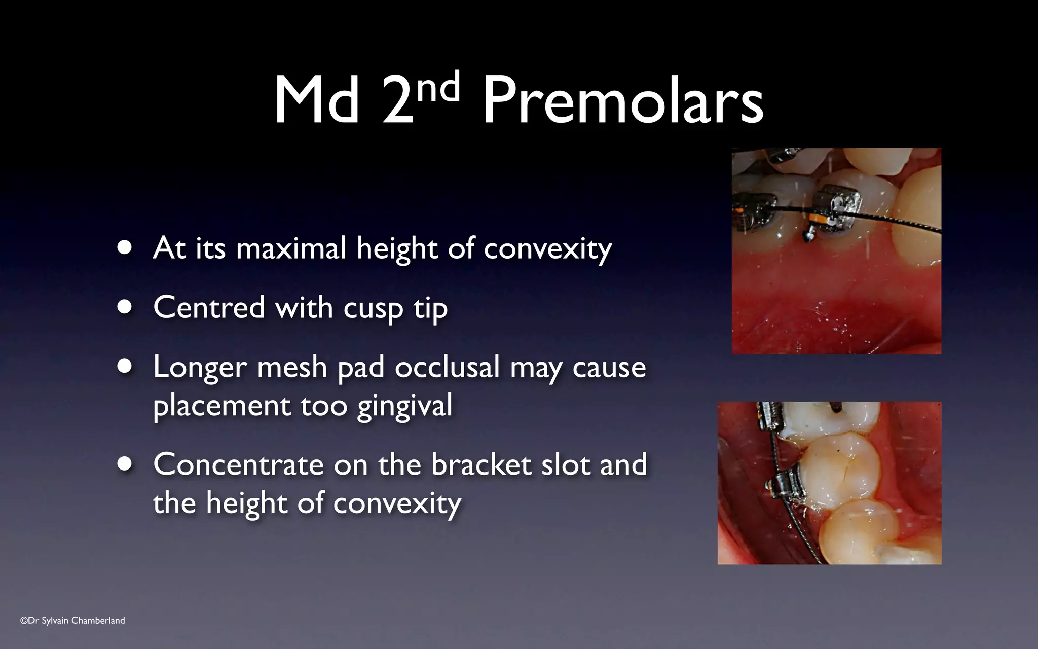 ©Dr Sylvain Chamberland
Md 2nd Premolars
• At its maximal height of convexity
• Centred with cusp tip
• Longer mesh pad occlusal may cause
placement too gingival
• Concentrate on the bracket slot and
the height of convexity
 