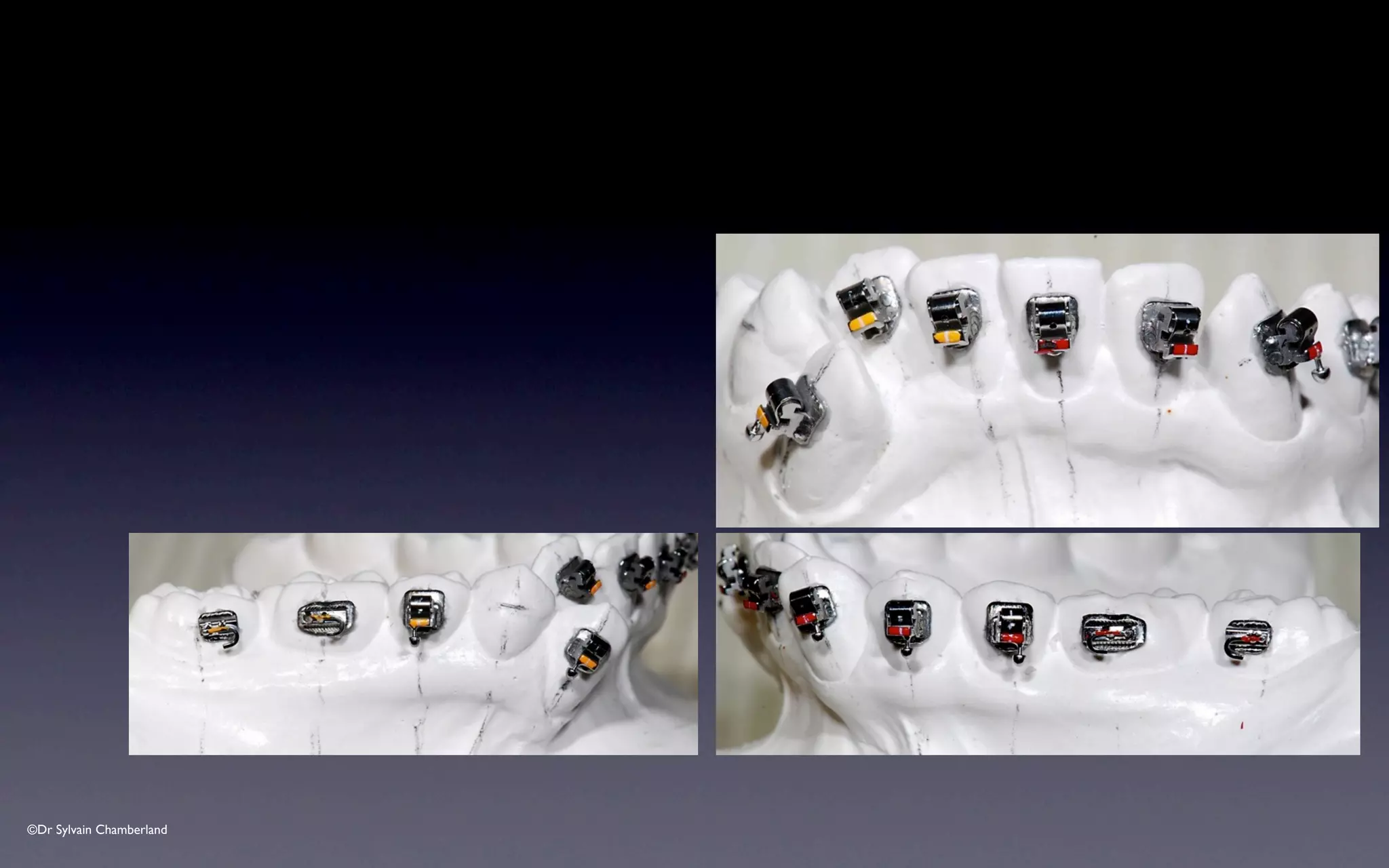 ©Dr Sylvain Chamberland
 