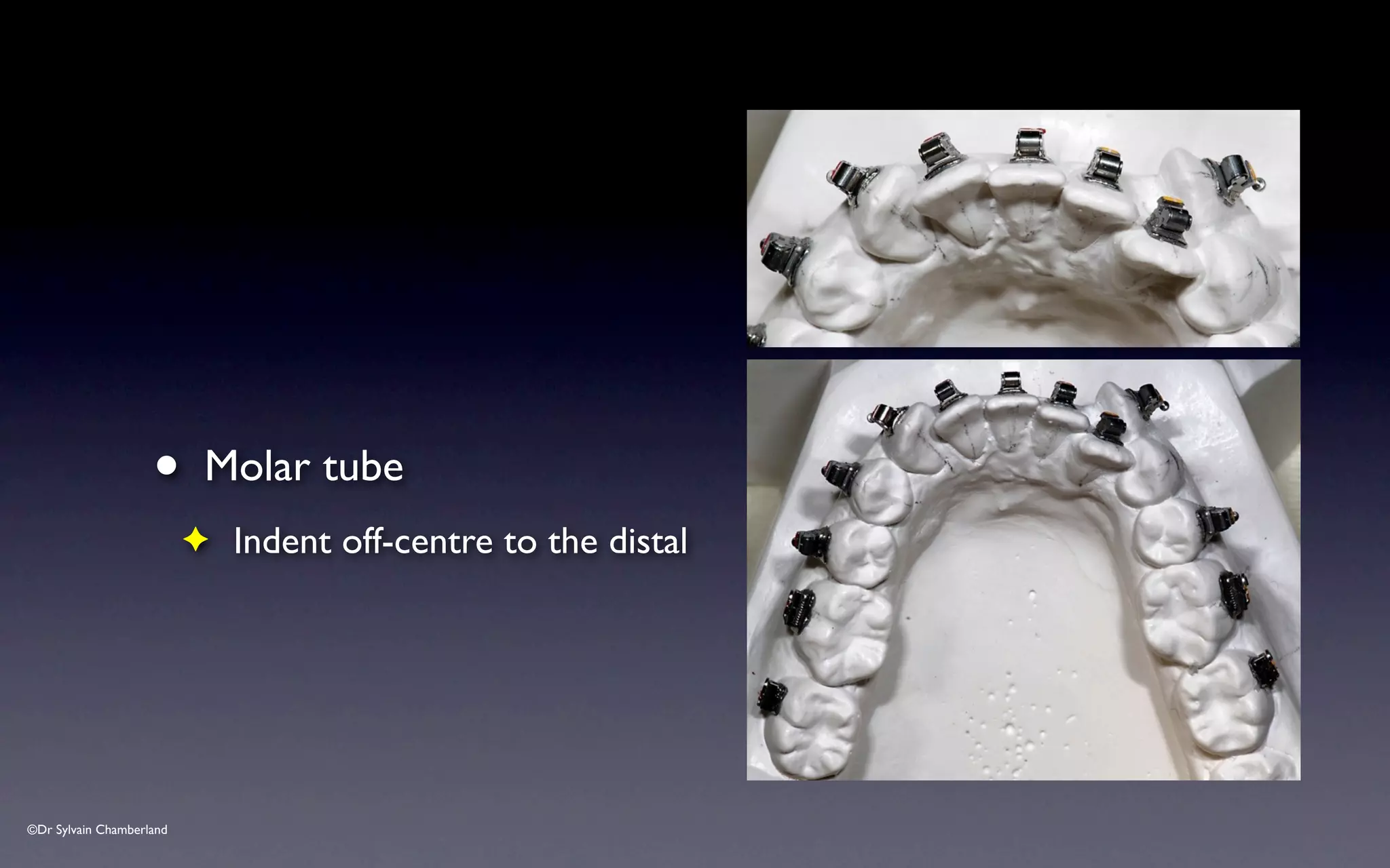 ©Dr Sylvain Chamberland
• Molar tube
✦ Indent off-centre to the distal
 